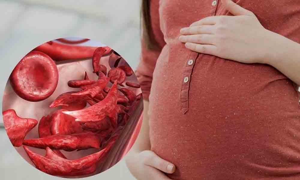 مصرف مکمل های کم خونی در دوران بارداری